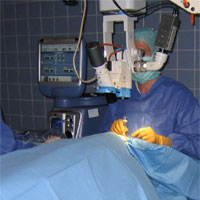 Kataraktoperation mit dem OP-Mikroskop